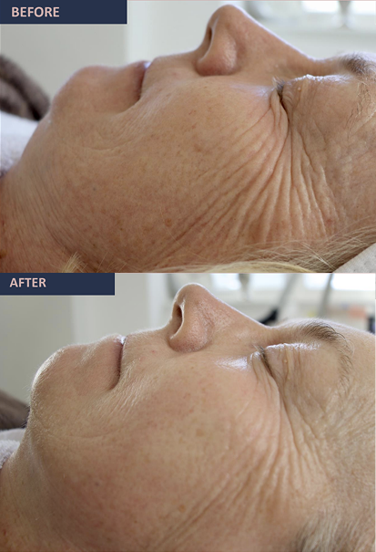 jetcare med before and after