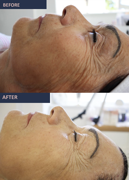 jetcare med before and after