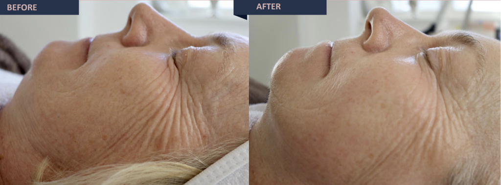jetcare med before and after