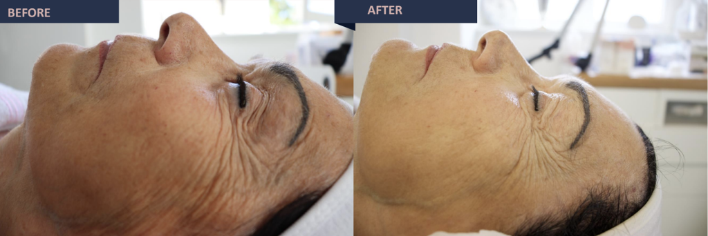 jetcare med before and after